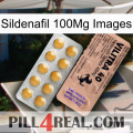 Sildenafil 100Mg Images 41